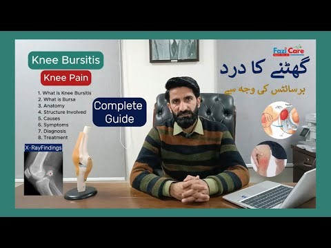 Understanding Knee Bursitis: Symptoms, Causes, Treatment, and Prevention