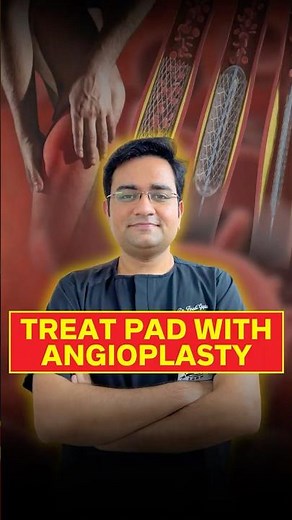 Save Your Leg with Angioplasty | No Major Surgery Needed for PAD