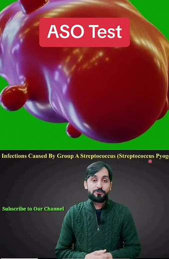 ASO Test (Complete Lecture) #LearnOnTikTok