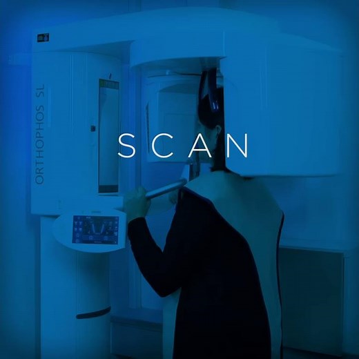 Simplant - Scan-Plan-Print