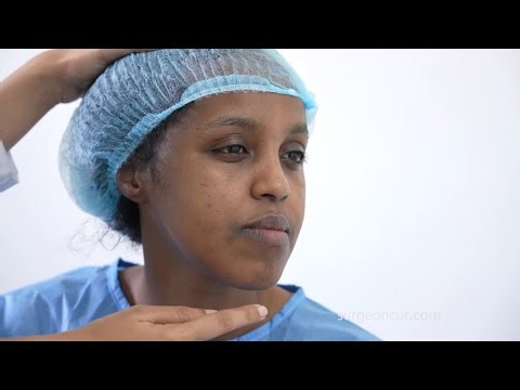 Underbite & open bite corrected along with incompetent lips and concave face -Before & After results