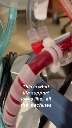 Life support and the machines #shorts #lvad #heartfailure #hospital #ecmo #balloonpump #lifesupport