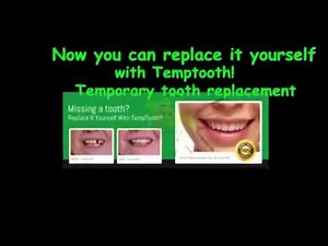 Quick Dental tooth like temptooth