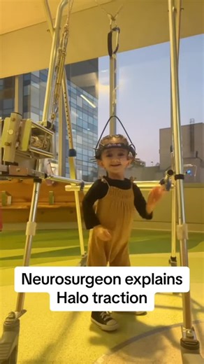 This is how we treat cases of severe scoliosis in the spine. #scoliosis #spinesurgery #scoliosissurgery #scoliosisfighter #scoliosisgang #scoliosistreatment #scoliosisawareness #pediatricscoliosis #neurosurgeon #spinesurgeon #raisingdion | Dr.Z Neurosurgery