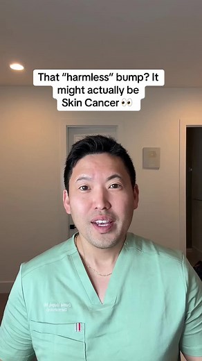 Dr. Daniel Sugai (@drspf)’s video of basal cell