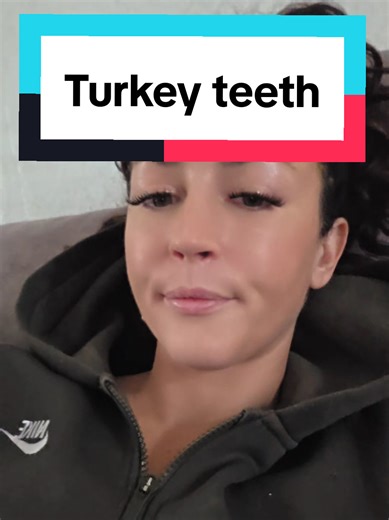 Exploring Health Risks of Mercury Fillings and Dentistry