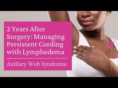2 Years After Surgery: How I Manage Persistent Axillary Web Syndrome (Cording) with Lymphedema