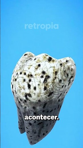 Can your tooth explode? 🤯