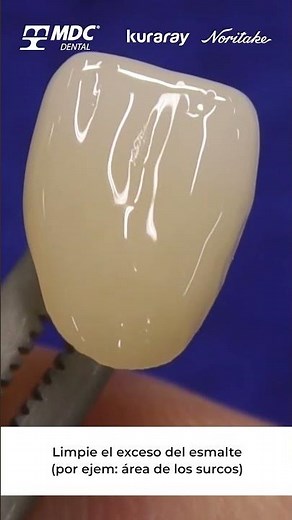 Tips Porcelana CZR Cerabien FC Paste Stain | Parte 2