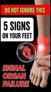 Sign Number 3: The 'Angry' Big Toe (Gout & Kidney Stress)