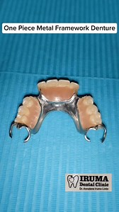 161K views · 387 reactions | Metal dentures have a great fit compared to acrylic dentures due to the way the metal is cast, meaning that they are more comfortable. #trendingreels #oralhealth #trend #oralcare #followers #DentalCare #DentalHealth #dental #pov #onepiece #onepiecemetal #fb #fbyシvideo #fbreelsfypシ゚ #fbreelsfypシ゚viralシ #trend #trendingnow #trendingreelsvideo | Iruma Dental Clinic | Facebook