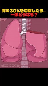 肺の30%を切除したら…一体どうなる？ #アニメ #膀胱 #コント