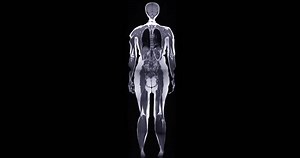 MRI whole body scans are beneficial for early cancer detection, monitoring chronic conditions, and overall health assessments.