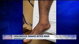 Venomous snake bites Florida man