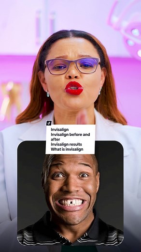 Transform Your Smile: Invisalign Before and After Results