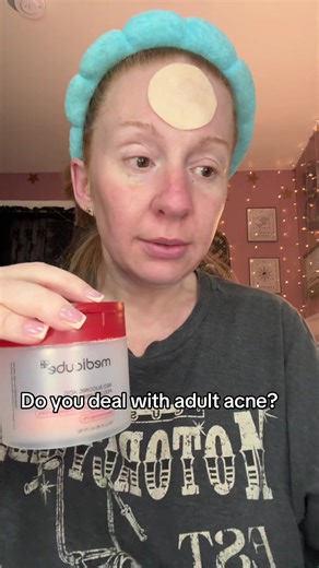 Effective Acne Pads for Adult Skin Care