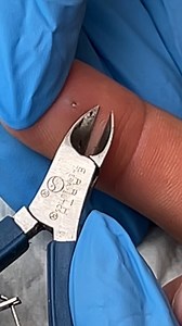 85M views · 231K reactions | They Got it out so quickly  . . Please...