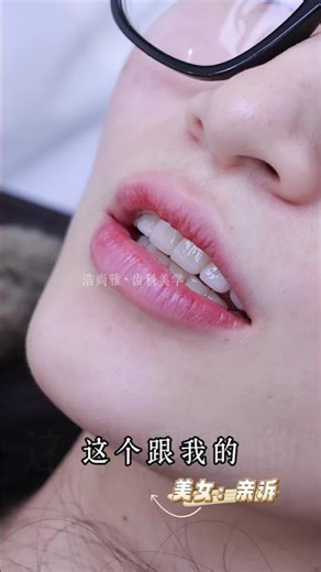 💄 Why is the makeup exquisite, but a smile fails? #dental
