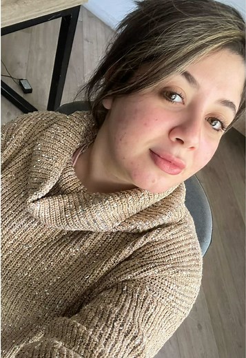 Understanding Lip Fillers: What You Need to Know