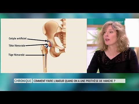 How to Make Love with a Hip Replacement? - Health Magazine