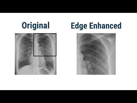 Image Filters (Smoothing Filter, Edge Enhancement Filters)