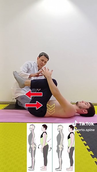Effective Exercises to Correct Hyperlordosis