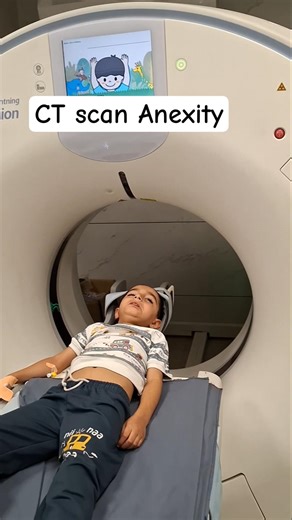 CT scan anexity in pediatric Brain #viral #shortsfeed #shortviral #short