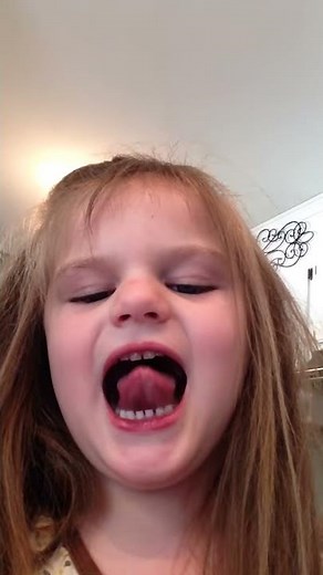 Isabella 32- Non-verbal Autistic Child Stimming with her Mouth, Sounds like "I"