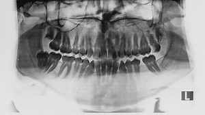 Dental x-ray - Free Stock Video