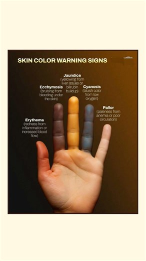 Skin Color Warning Signs You Should Never Ignore | Health Awareness #skincancer #SkinSigns