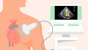 Când e utilă o ecografie cardiacă și cum o faci gratuit