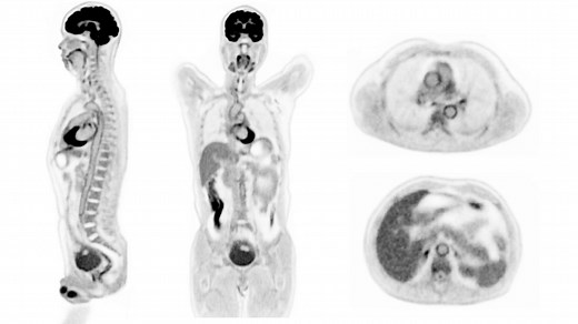 Pour la première fois, un scanner peut voir votre corps entier en 3D