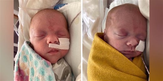 Hospital sees high number of twin births