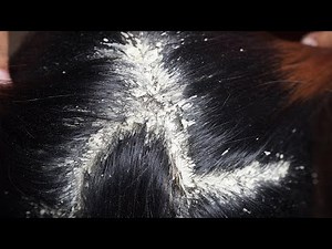 Deep Scratch Reveal: Thick Flake Layers Hidden Below #499