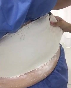 1.4K views · 59 reactions | Fajas de yeso lipolitico: La yesoterapia es un tratamiento para disminuir volumen corporal. Funciona mediante vendas de yeso lipolitico que contiene productos de alta calidad. Beneficios disminuye celulitis disminuye estrías elimina flacidez Pide tu venda de yeso por tan solo $200  La sesión dura 1 hr 20 minutos y se te regala un masaje de electroestimulacion para grasa localizada!! | Magicshifting Terapias alternativas | Facebook