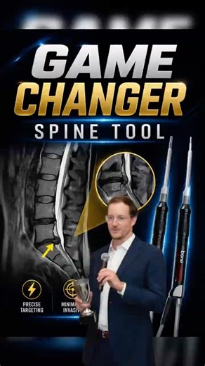 Stenosis Game Changer for my Dallas Patients (Macro Hook)