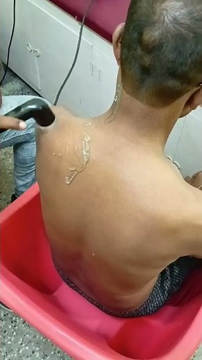 Ultrasound Therapy (UST)