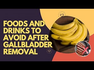 Foods and Drinks to Avoid After Gallbladder Removal