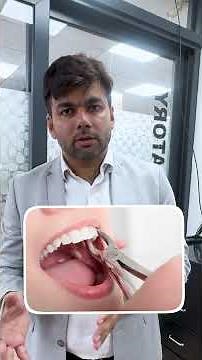 Bimaxillary Protrusion: Extraction & Anchorage Strategy Explained