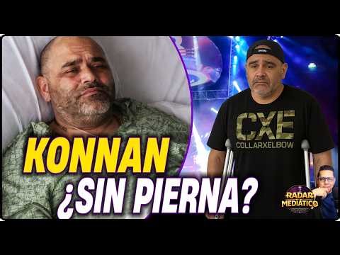 Konnan without a leg?: This is how the silence grows that fuels a devastating rumor