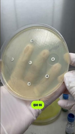 How to interpret the antibiogram? #shorts