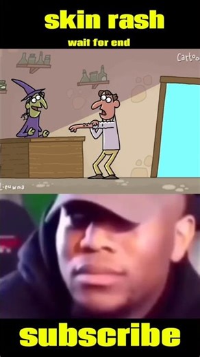 skin rash 😂😂....#shorts #shortvideo #trending