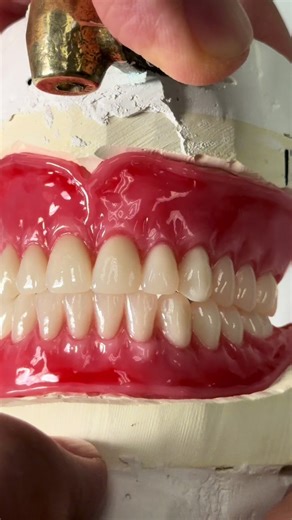 Wax Try-In Process for Dr. William Bennett