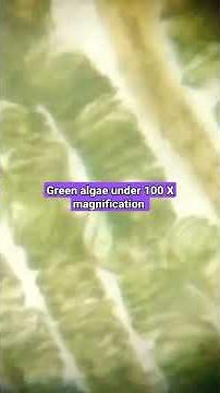 spirogyra green algae magnified under microscope to show cholorophyll cholroplast organelles