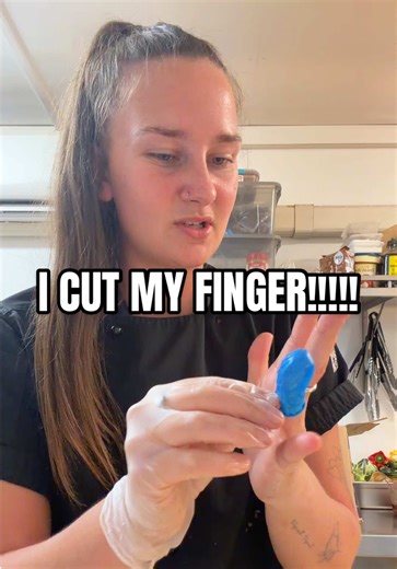 Accidents in the Kitchen: When Cooking Goes Wrong