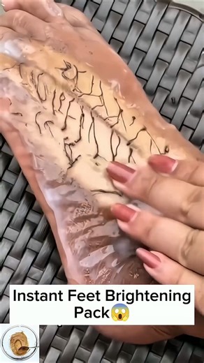 Dark Feet Cleaning Tips | Remove Feet Dirt & Dead Skin, Get Fair Feet Instantly #suntan #skincare