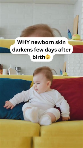 180K views · 828 reactions | Why Does a Newborn's Skin Get Darker...