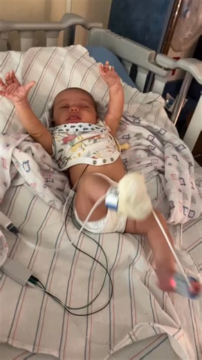 She started having seizures at one month old… and they still told me nothing was wrong. Those early days were filled with fear, confusion, and a gut feeling I couldn’t shake. I didn’t want to be right I just wanted someone to listen. If you’re a parent in the beginning of the fight: keep going. Your voice matters more than you know. 🤍 #MCAHS1 #pign #fyp #cdg #foryou #viral #rare #inclusionmatters #Disability #hope4hazel #medical #hospital #doctor #disabilityawareness #Grief #baby | Hazel Mae - 