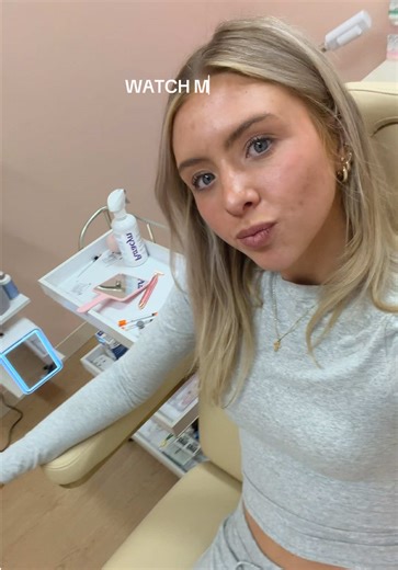 Watch Botox Results Progress Over 11 Days