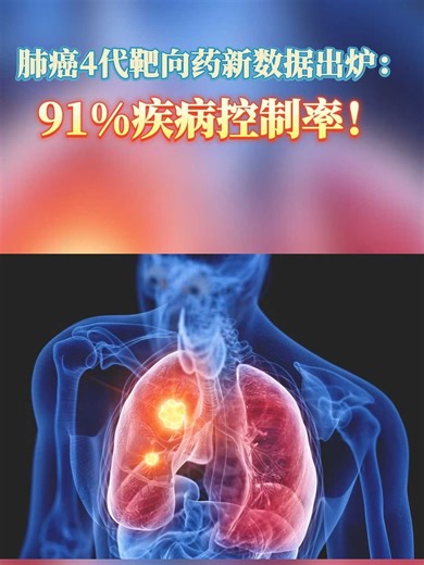 肺Ca新资讯！关注海外医疗前沿
